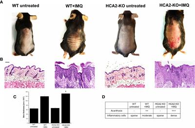 Crosstalk between microbiome, regulatory T cells and HCA2 orchestrates the inflammatory response in a murine psoriasis model